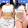 CelluSculpt™ – Anti-Cellulite-Massagegerät