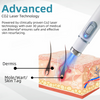 DermaLase™ | Nicht-invasive Maulwurf- und Warzenentfernung Laser Pen Promax