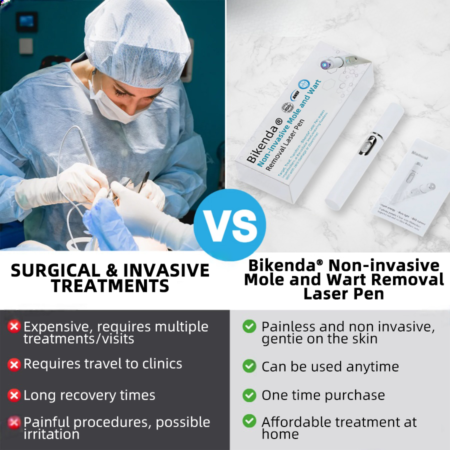 DermaLase™ | Nicht-invasive Maulwurf- und Warzenentfernung Laser Pen Promax