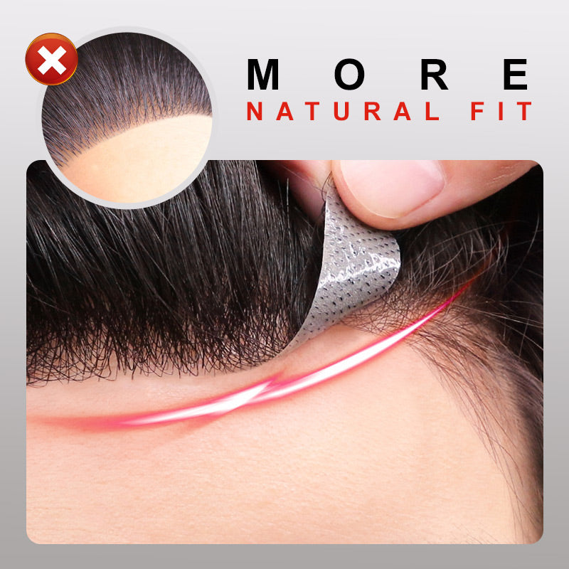 VoluMen™ HairPatch | Herren-Haarteil für den Scheitelbereich Direkte Beleuchtung