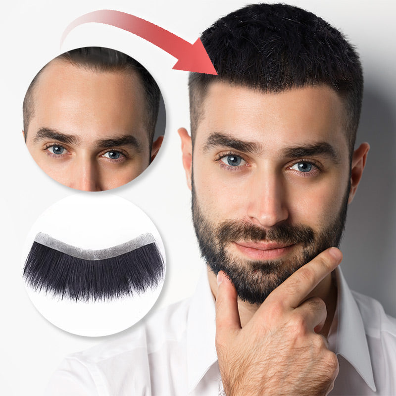 VoluMen™ HairPatch | Herren-Haarteil für den Scheitelbereich Direkte Beleuchtung