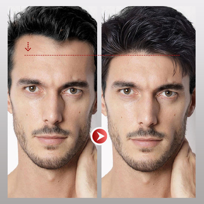 VoluMen™ HairPatch | Herren-Haarteil für den Scheitelbereich Direkte Beleuchtung