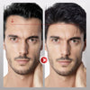 VoluMen™ HairPatch | Herren-Haarteil für den Scheitelbereich Direkte Beleuchtung