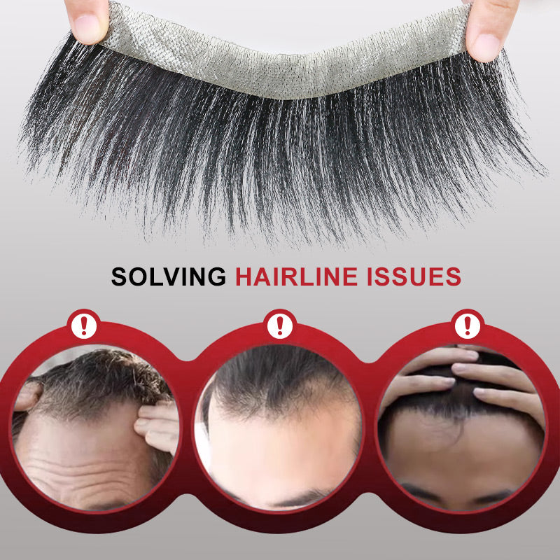 VoluMen™ HairPatch | Herren-Haarteil für den Scheitelbereich Direkte Beleuchtung