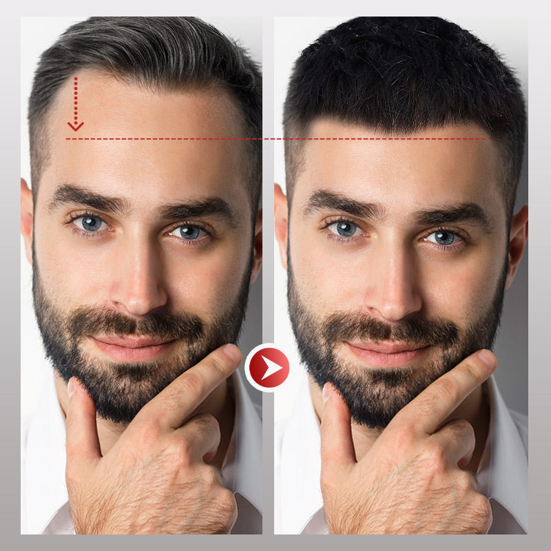 VoluMen™ HairPatch | Herren-Haarteil für den Scheitelbereich Direkte Beleuchtung