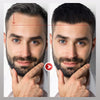 VoluMen™ HairPatch | Herren-Haarteil für den Scheitelbereich Direkte Beleuchtung